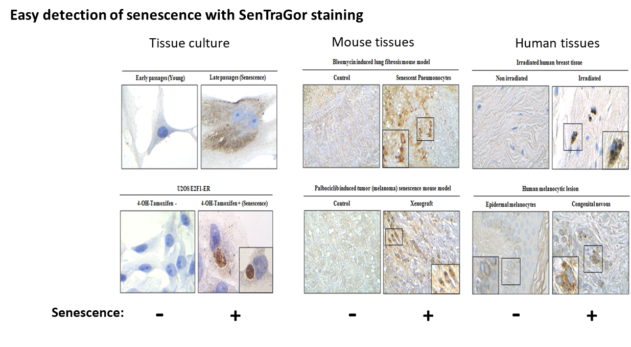 Different samples of tissue with SenTraGor staining.