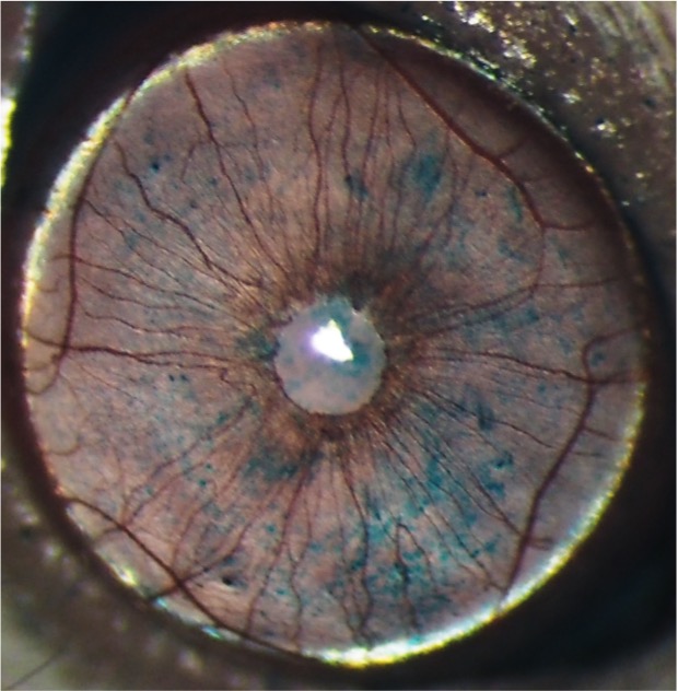 Restasis treated eye- Innovation Factory