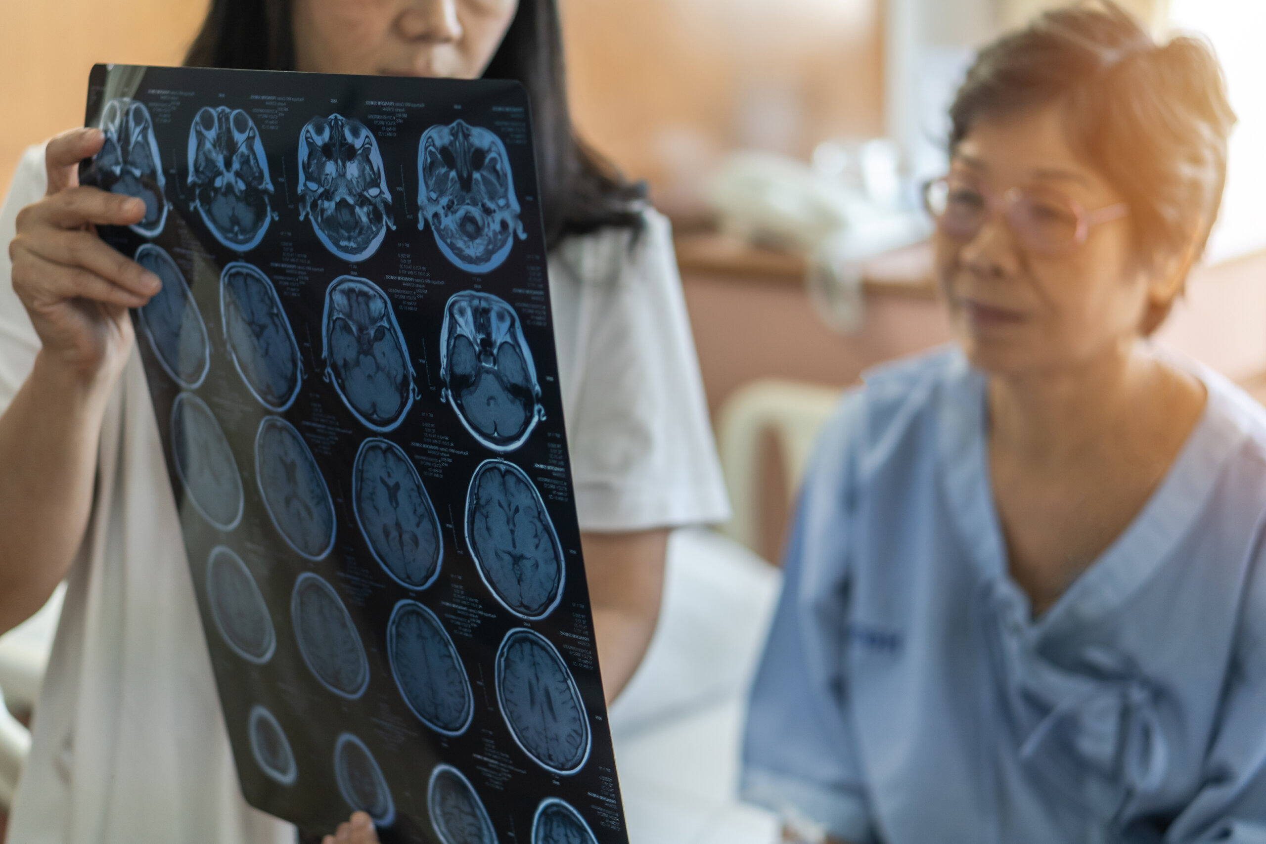 Brain disease diagnosis with medical doctor diagnosing elderly ageing patient neurodegenerative illness problem seeing Magnetic Resonance Imaging (MRI) film for neurological medical treatment